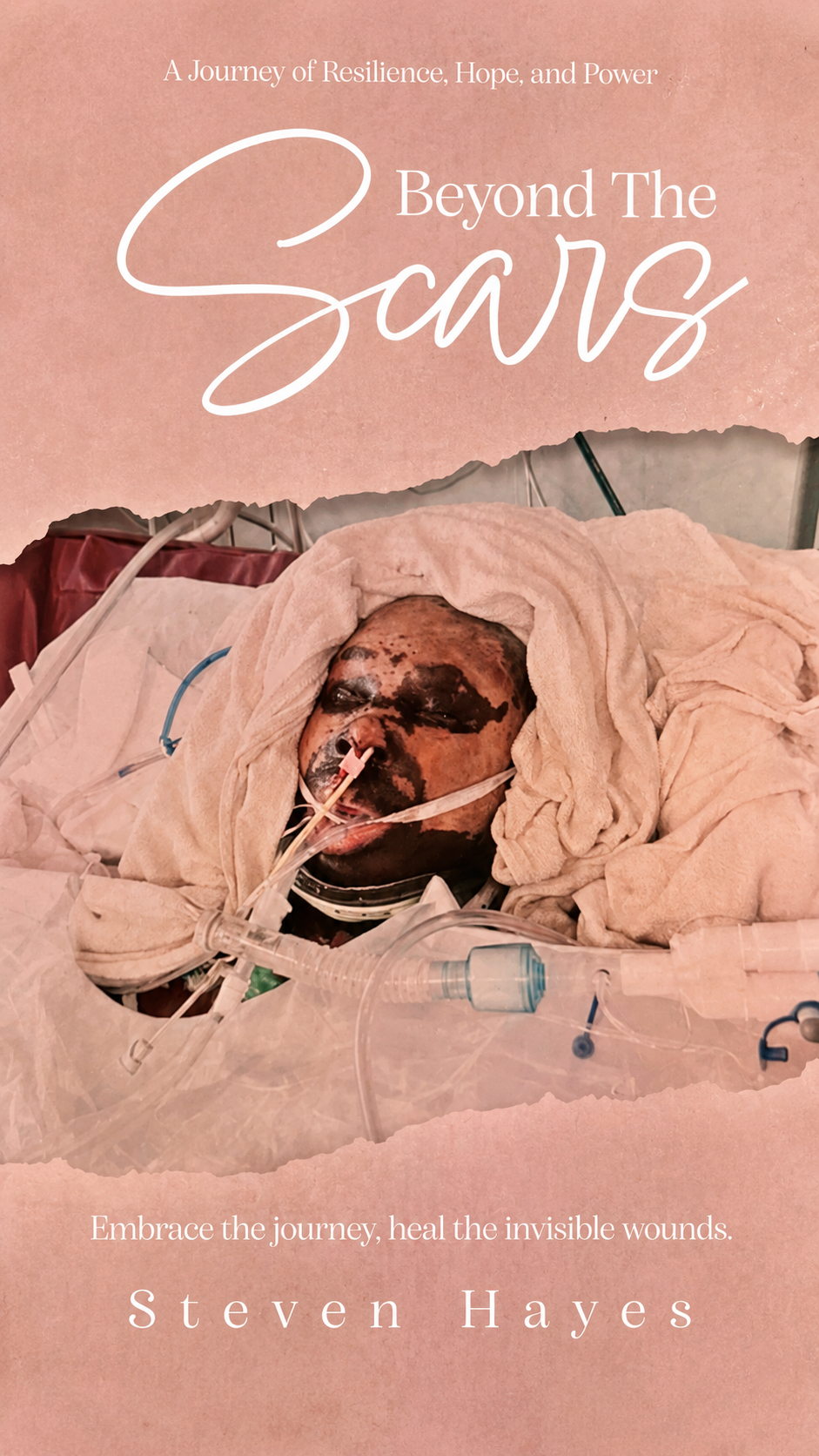 Beyond The Scars cover